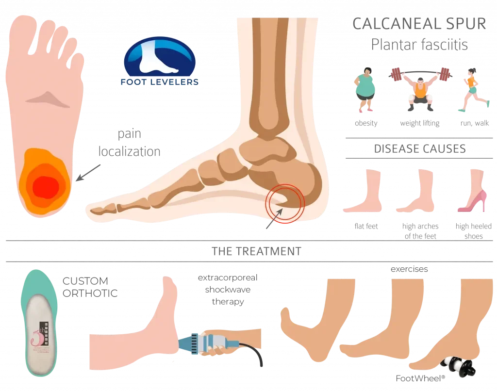 Why Do I Have Heel Pain? Find Out Here! | Cornerstone Foot & Ankle